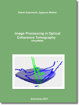 Image Processing In Optical Coherence Tomography by Robert Koprowski, Zygmunt Wrobel